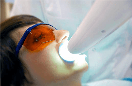 Understanding the Causes of Teeth Sensitivity Shrewsbury