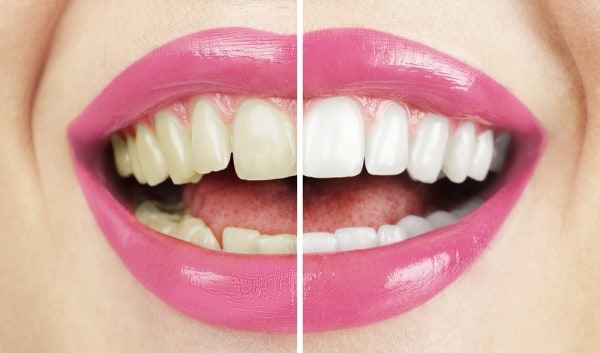 What Early Signs of Oral Cancer Should You Never Ignore Shrewsbury?