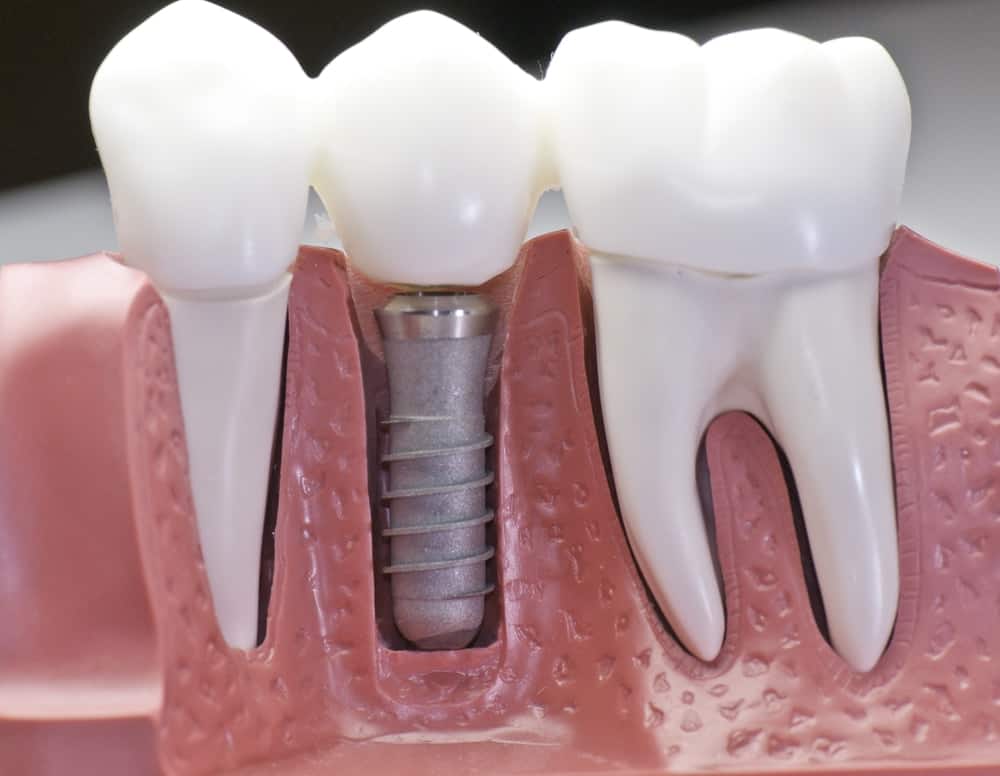 Common Misconceptions About Modern Dental Treatments Shrewsbury