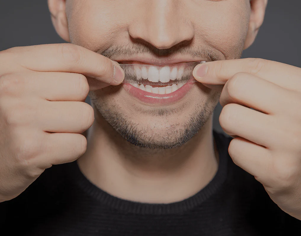 How Are Invisible Aligners Changing Orthodontic Treatments Shrewsbury?