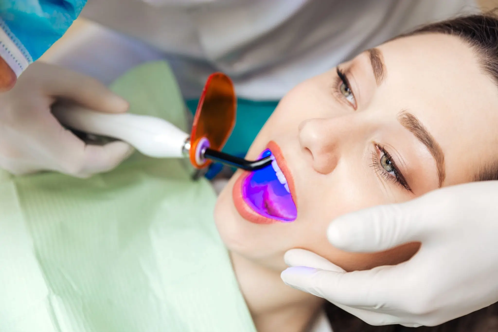 Common Risks of Whitening Without Expert Dental Guidance Shrewsbury