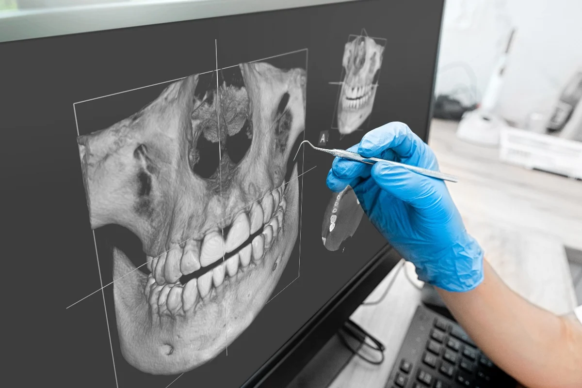 Key Benefits of 3D Printing for Patients and Dentists Shrewsbury