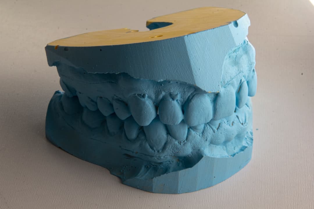How Do Dental Implants Improve Jawbone Health and Oral Function Shrewsbury?