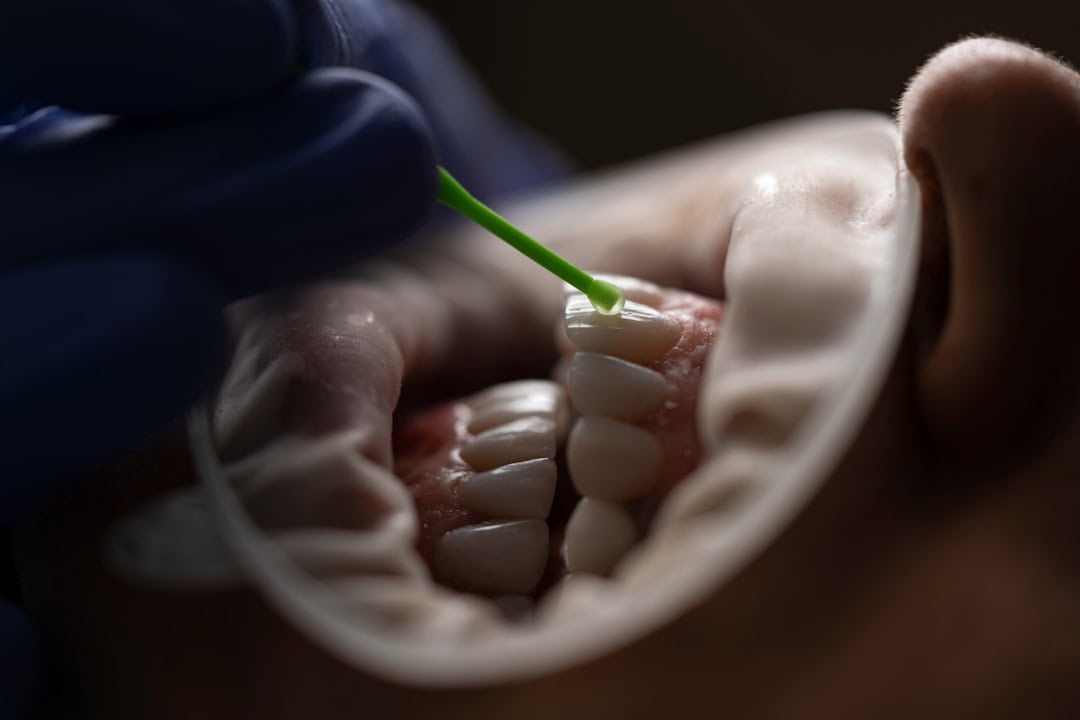 How Saliva Protects Your Teeth and Gums Shrewsbury