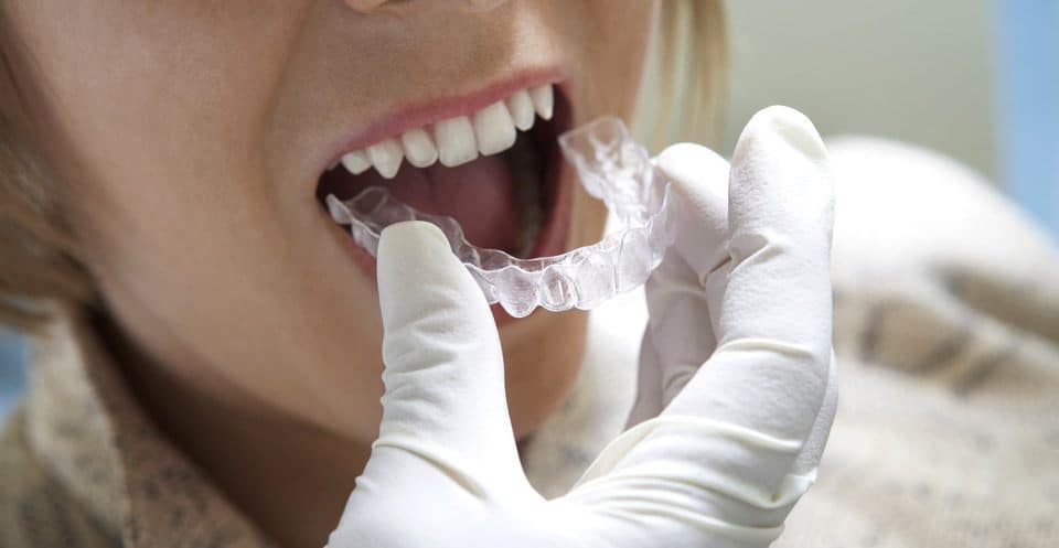 Can Bruxism Affect Your Sleep Quality Shrewsbury