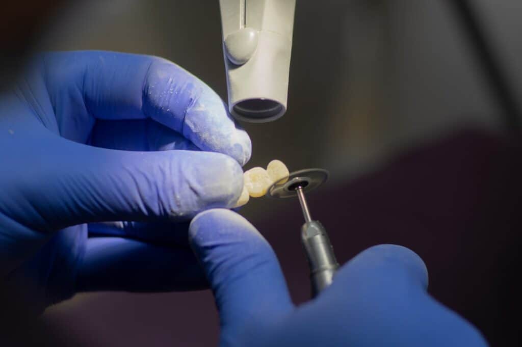 Customised Dental Solutions: Crowns, Aligners, and Implants Shrewsbury