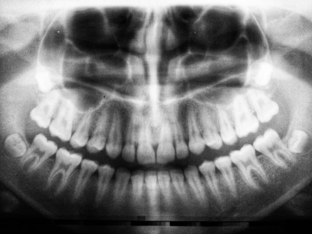 The Future of 3D Printing in Oral Healthcare Shrewsbury